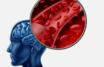 Os síntomas da osteocondrose da columna cervical
