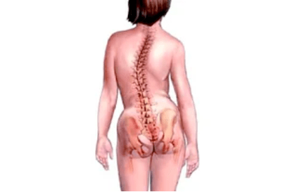 Razóns para o desenvolvemento da osteocondrose cervical