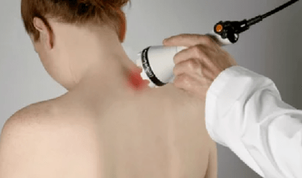 Tratamento da osteocondrose cervical con métodos fisioterapéuticos