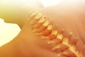 Como tratar a osteocondrose